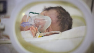 bronquiolite pelo VSR em prematuros