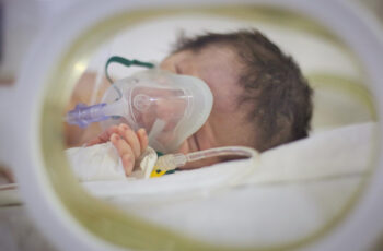 Bronquiolite pelo VSR é mais grave em prematuros